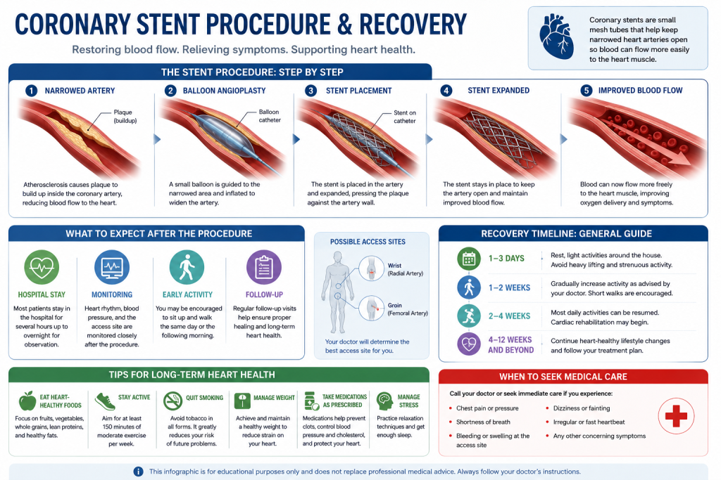 Infographic explaining coronary stent procedure and recovery