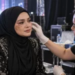Female singer receiving medical attention for facial bruising backstage